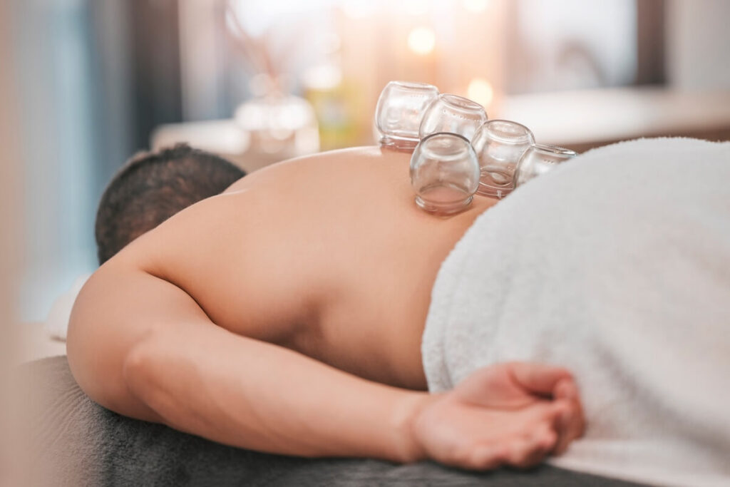 A patient lies face down with glass cups applied to the back for pain relief and relaxation.