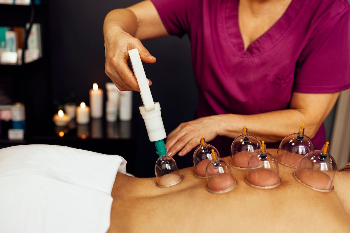 Cupping Therapy Benefits: How It Works and What It Treats