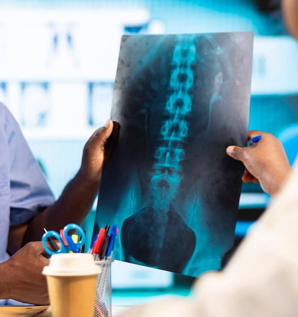 Doctor reviewing a patient's x-ray for signs of spinal stenosis.
